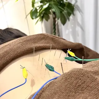 Spring鍼灸院所属・Spring鍼灸院 ✨首肩こり、腰痛に！のエステ・リラクイメージ