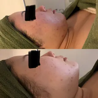 よもぎ蒸しサロンc.iエステティック所属・睡眠の質／体質改善 c.iエステティックのエステ・リラクイメージ