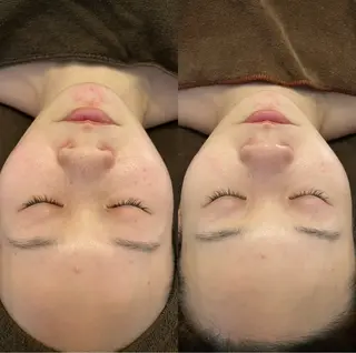 oyam オヤムのエステ・リラクイメージ