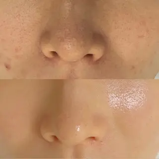 ショート aliaハイフ&水光ジェットサロン所属・aliaハーブ水光店 エステティシャン募集のエステ・リラクイメージ