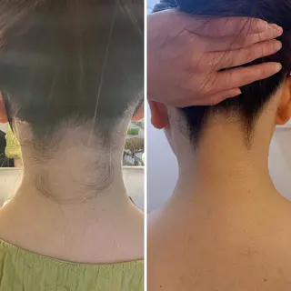 うなじ脱毛/美肌脱毛 LABELのエステ・リラクイメージ