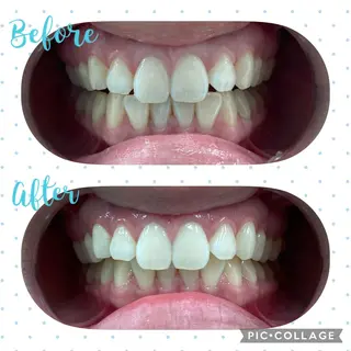 セルフホワイトニングCOCOSHIRO所属・セルフホワイトニング COCOSHIROのエステ・リラクイメージ