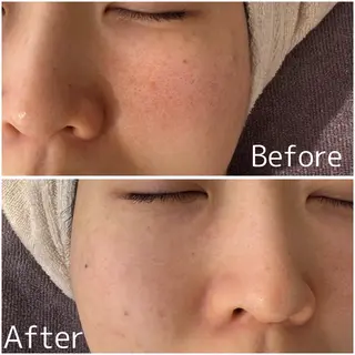 MiEL total beauty salon所属・脱毛サロン MiELのエステ・リラクイメージ