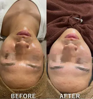 美容革命ラボ 福岡のエステ・リラクイメージ