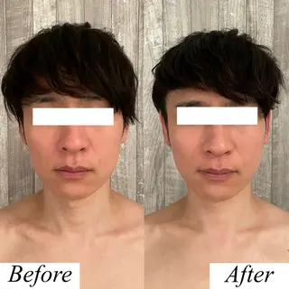 メンズ グレースフィオーレ上野御徒町店所属・頭蓋骨小顔矯正 上野御徒町店＊かんなのエステ・リラクイメージ