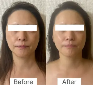 la lumie're (ラ リュミエール)所属・小顔サロン (ラ リュミエール)のエステ・リラクイメージ