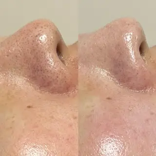 ๐๐๐๐ก๐ ๐๐ฒ ๐๐๐ฒ๐ฎๆๅฑใปใใผใใใผใชใณใฐ๐ฟ ๐ด๐๐๐ใฎใจในใใปใชใฉใฏใคใกใผใธ