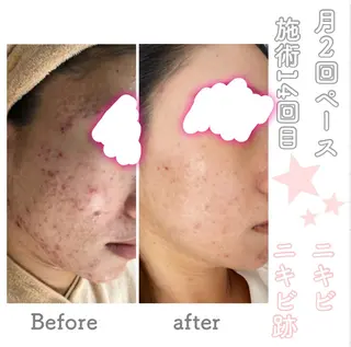 ショート カラー パーマ ヘアアレンジ メンズ キッズ ネイル マツエク・マツパ ニキビ&跡改善サロン オーナー光木のエステ・リラクイメージ