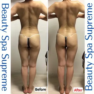 BeautySpaSupreme所属・Beauty Spa Supreme小玉のエステ・リラクイメージ