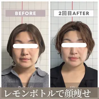 【小顔リフト×小顔矯正専門店】RED所属・猿渡 ひかるのエステ・リラクイメージ