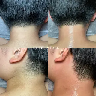 ショート HOTEL&PARK . ワックス脱毛のエステ・リラクイメージ