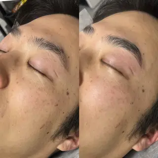 アイブロウ Mr.&Ms.脱毛 NATSUMIのエステ・リラクイメージ