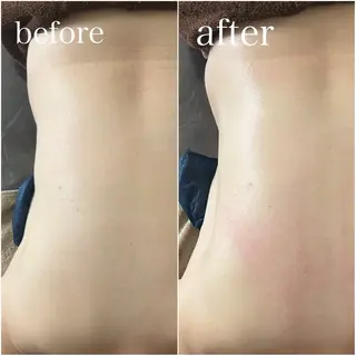 PIUMA 筋膜リリース・リンパのエステ・リラクイメージ