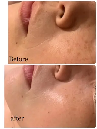 espoir エスポワールのエステ・リラクイメージ