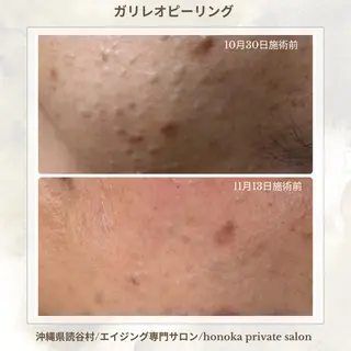 知念 美由紀のエステ・リラクイメージ