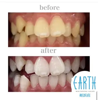 メンズ ホワイトニングサロン EARTH福岡姪浜店のその他イメージ