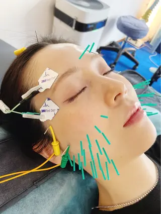 小顔美容鍼専門サロン 渋谷YZのその他イメージ