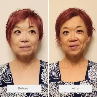 即効⚡小顔美容鍼🪡 むくみたるみ脂肪解消のエステ・リラクイメージ