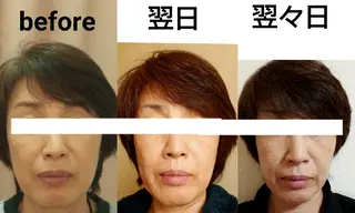 小顔と美肌 まごころエステMatoria所属・小顔 美肌専門 Matoriaのエステ・リラクイメージ