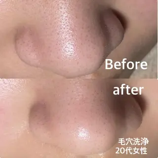 NICOLAUGH/ 村松【小顔.ボディ】のエステ・リラクイメージ