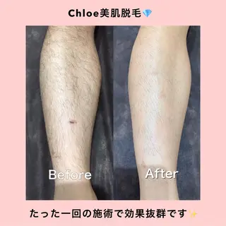 セミロング カラー パーマ ヘアアレンジ メンズ キッズ ネイル マツエク・マツパ Chloe-クロエ- 脱毛/フェイシャルのエステ・リラクイメージ
