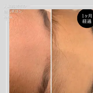 女性専用脱毛 サロンvivio.のエステ・リラクイメージ