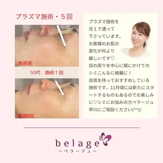 ベラージュ【美背中・ 美尻・フェイシャル】のエステ・リラクイメージ