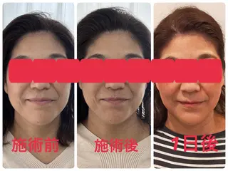 Serapia 【セラピア】のマツエク・マツパデザイン