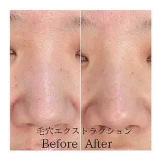  毛穴洗浄・まつ毛 の専門店 ソラーレのエステ・リラクイメージ