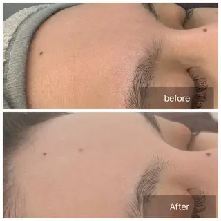 トータルしみケア専門 NICA(ニカ)のエステ・リラクイメージ