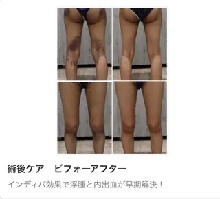 INDIBA Salon Frangipani 新宿所属・INDIBA サロン フランジパニ新宿のエステ・リラクイメージ