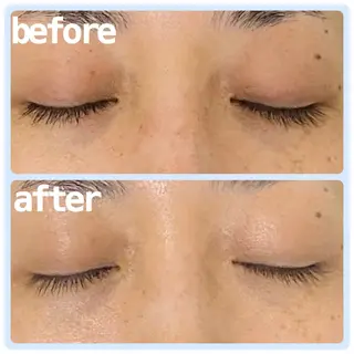 aimer beautyのエステ・リラクイメージ