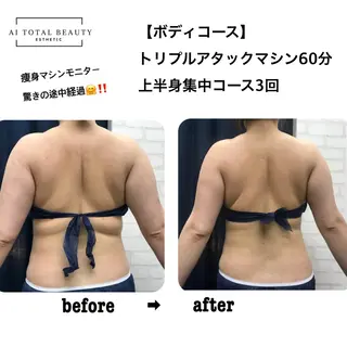 アイトータル ビューティーのエステ・リラクイメージ