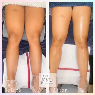 SHARES MADOKAのエステ・リラクイメージ