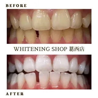 メンズ ホワイトニング ショップ葛西店のその他イメージ