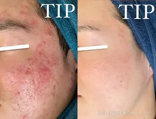 Mau beauty salon所属・Mau (マウ)のエステ・リラクイメージ