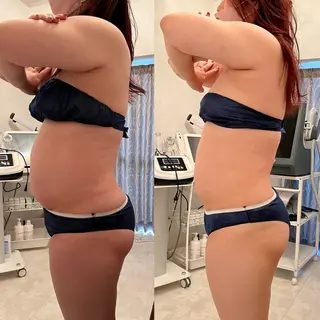 Remina clinical salon所属・ハイフ美肌専門 Remina.c.sのエステ・リラクイメージ