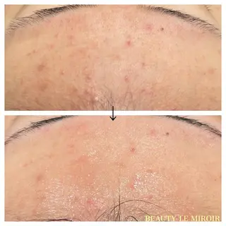 マツエク・マツパ ビューティー ミロワールのエステ・リラクイメージ