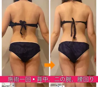 ロング カラー パーマ ヘアアレンジ メンズ キッズ ネイル マツエク・マツパ ‍痩身＆ボディ 結果出し🌟丹野のエステ・リラクイメージ