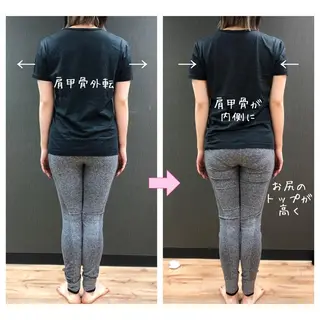 小顔モニター 募集のエステ・リラクイメージ