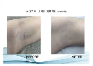 total beauty HAPPY所属・O. Minaのその他イメージ