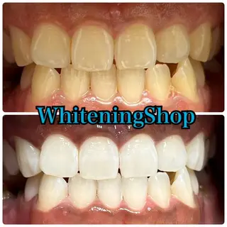 ホワイトニング ショップ吉祥寺店のエステ・リラクイメージ