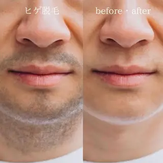 メンズ An Blossom所属・An Blossom 脱毛/茅ヶ崎/美咲のエステ・リラクイメージ