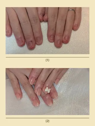 ネイル フィルイン、長さ出し 深爪矯正のネイルデザイン