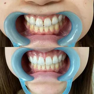 R E O T I A R A（レオティアラ）所属・高屋 昌子のその他イメージ