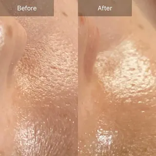 Mandarin Orange所属・毛穴から始める肌メン テマンダリンオレンジのエステ・リラクイメージ