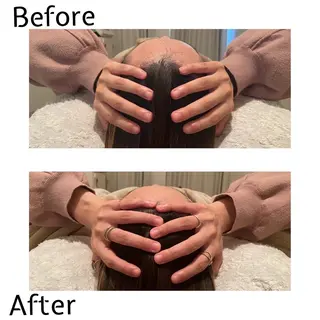 トータルサロンRuby所属・【医療提携】小顔 整体ハーブピーリングのその他イメージ