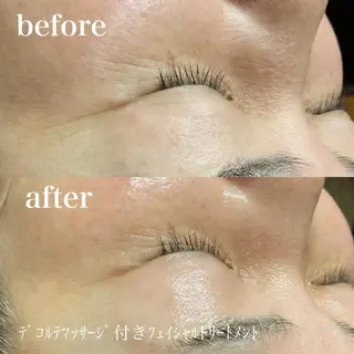 磐田｜LAYLA 一番丁寧な脱毛店のエステ・リラクイメージ