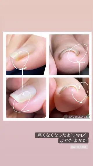 ネイル atelier nife.のネイルデザイン