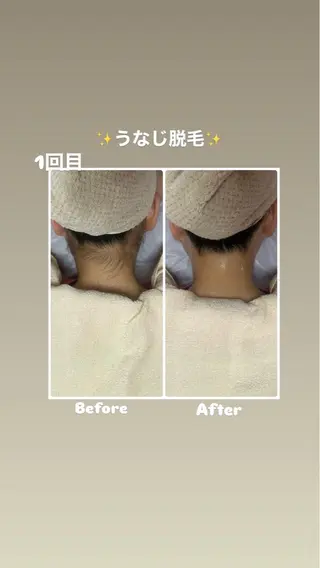 脱毛サロン エクボスタッフのエステ・リラクイメージ